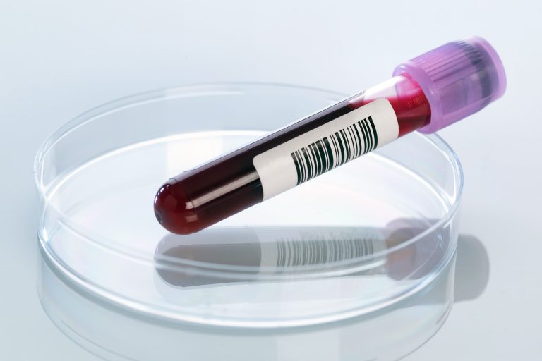 1800x1200_blood_sample_in_petri_dish_other.jpg