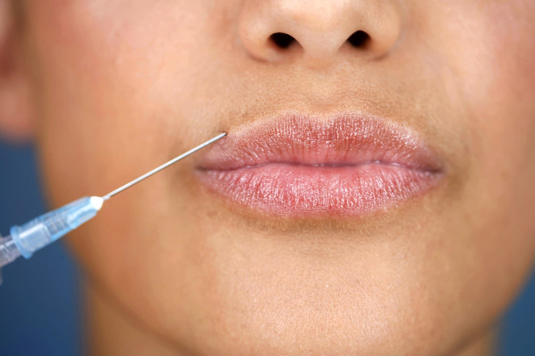 1800x1200_what_you_should_know_before_getting_facial_fillers_slideshow.jpg