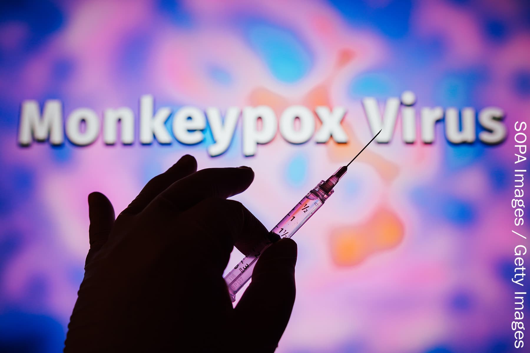 1800x1200_getty_rm_monkeypox_virus.jpg
