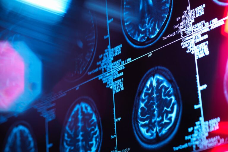 alzheimers_nl_module_1800x1200.jpg